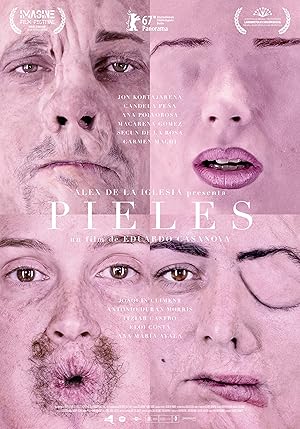 Skins (Pieles)